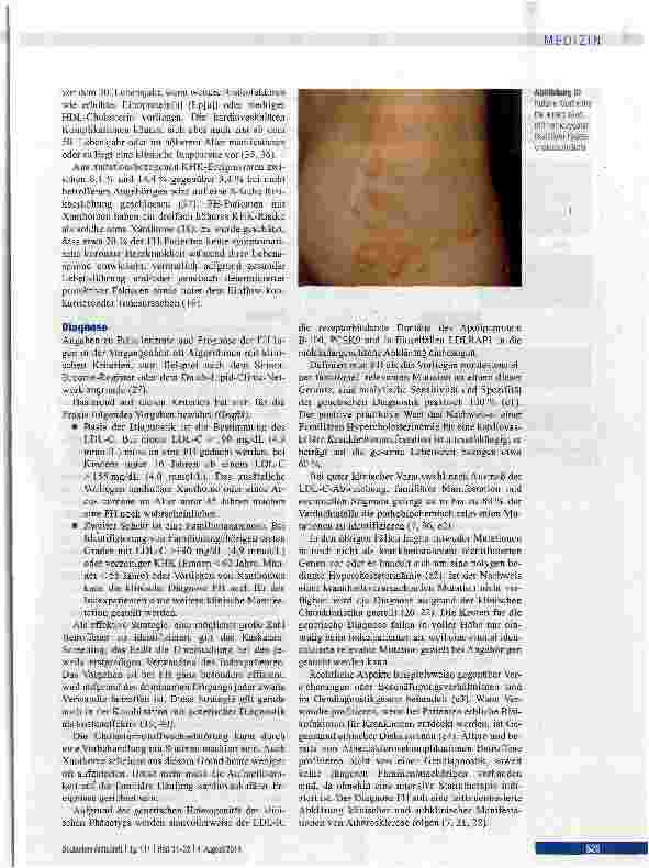 Vorschauseite 3: Familiäre Hypercholesterinämie: Entwicklungen in Diagnostik und Behandlung