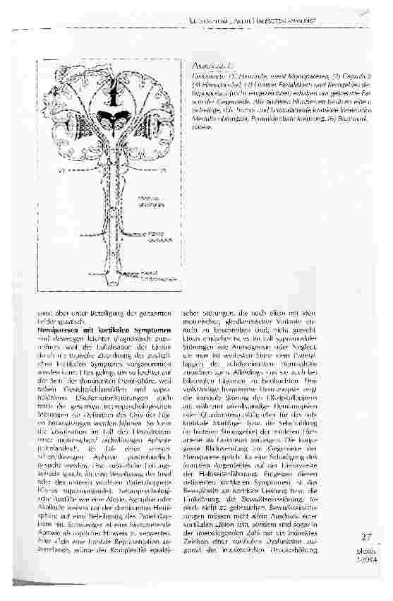 Vorschauseite 3: LEITSYMPTOM AKUTE HALBSEITENLÄHMUNG