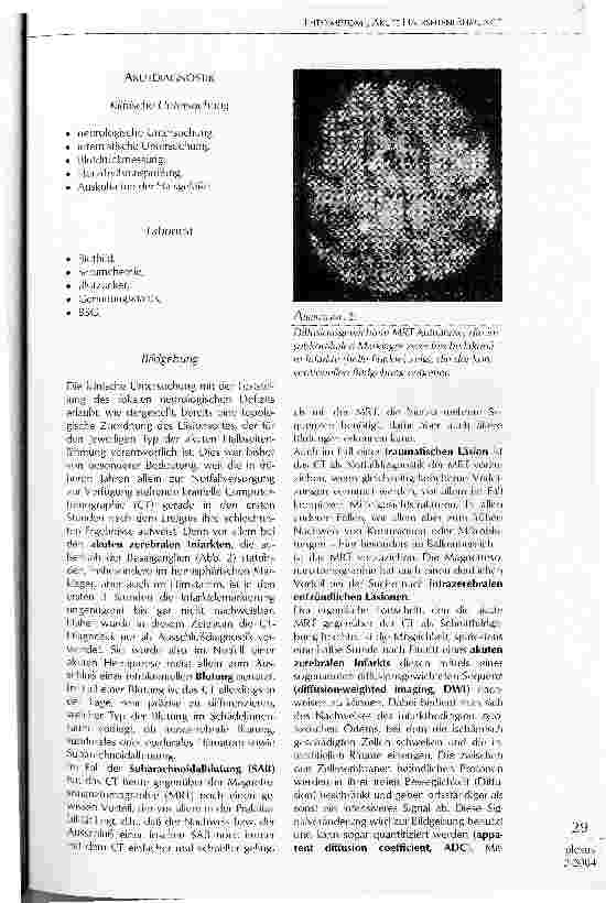 Vorschauseite 5: LEITSYMPTOM AKUTE HALBSEITENLÄHMUNG