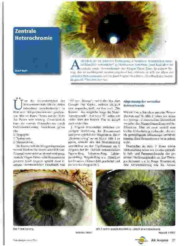 Vorschauseite 1: Zentrale Heterochromie