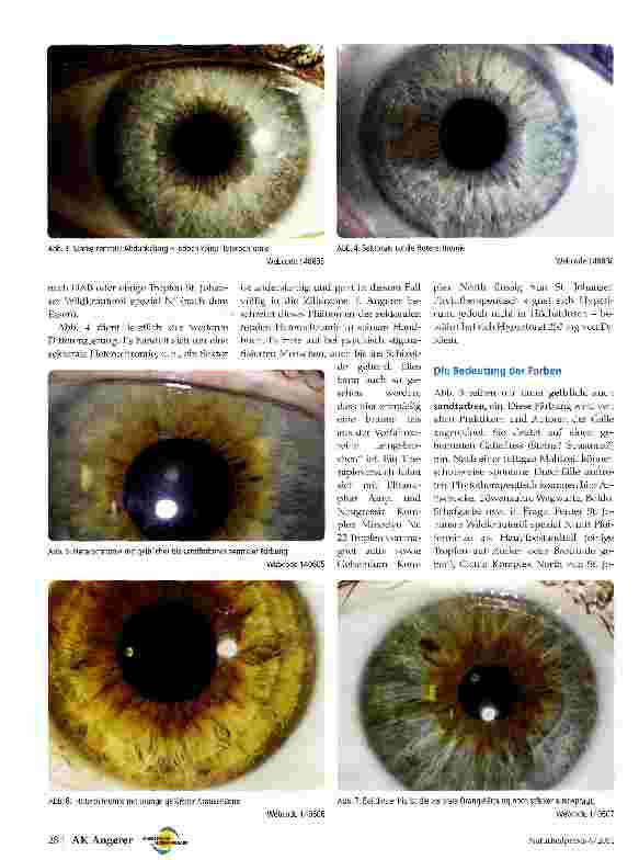 Vorschauseite 2: Zentrale Heterochromie