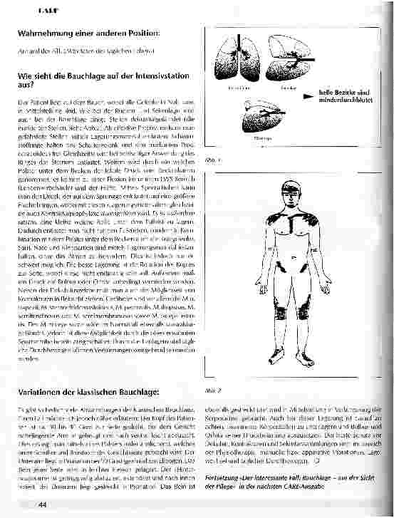 Vorschauseite 2: Der interessante Fall: Die Bauchlage auf der Intensivstation - aus der Sicht der Physiotherapie