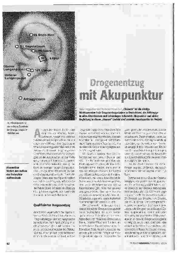 Vorschauseite 1: Drogenentzug mit Akupunktur