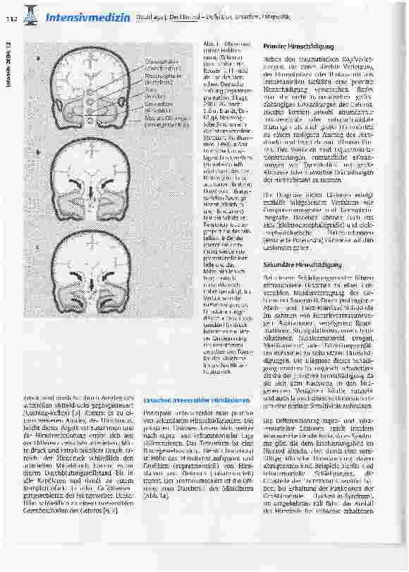 Vorschauseite 2: Der Hirntod - Definition, Ursachen, Diagnostik