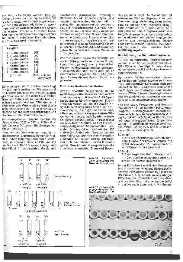 Vorschauseite 5: Transfusionskunde, Blutgruppenserologie und Immunhämatologie 30. Folge:Der Radioimmunoassay (RIA) zum Nachweiß v. Australia-Antigen