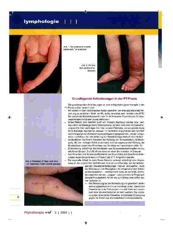 Vorschauseite 2: Komplexe Physikalische Entstauungstherapie Grundlagen, Argumente, praktische Tipps