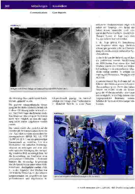 Vorschauseite 3: ECMO als Baustein im Behandlungsalgorithmus des schweren thorakalen Traumas
