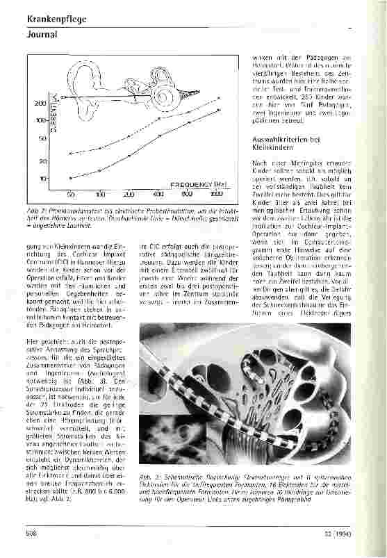 Vorschauseite 3: Cochlear Implant bei Kindern