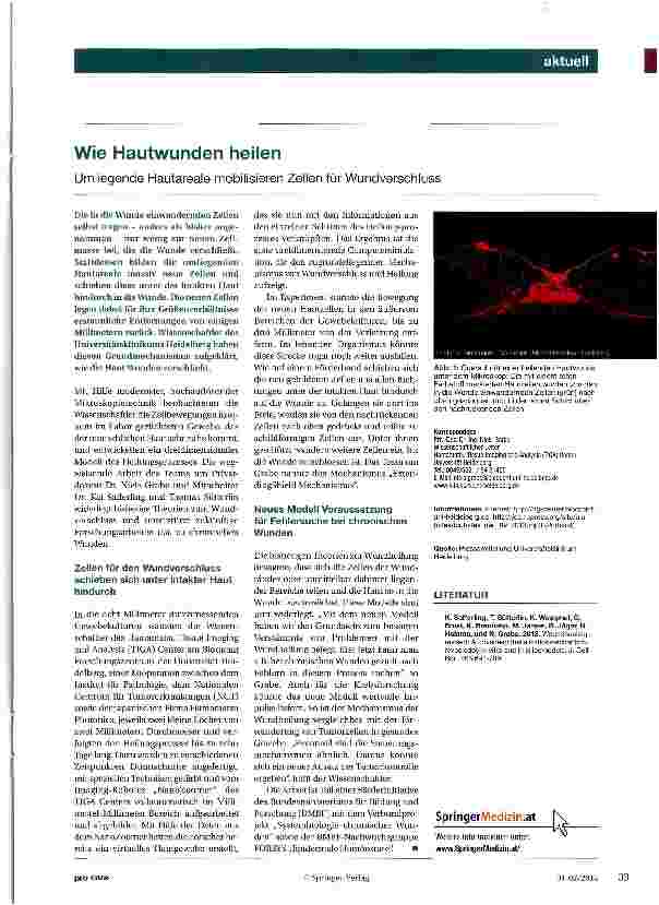 Vorschauseite 1: Wie Hautwunden heilenUmliegende Hautareale mobilisieren Zellen für Wundverschluss