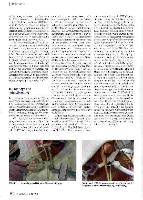 Vorschauseite 4: Mundpflege beim intubierten beatmeten Intensivpatienten