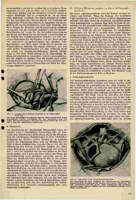 Vorschauseite 3: Herzchirurgie
