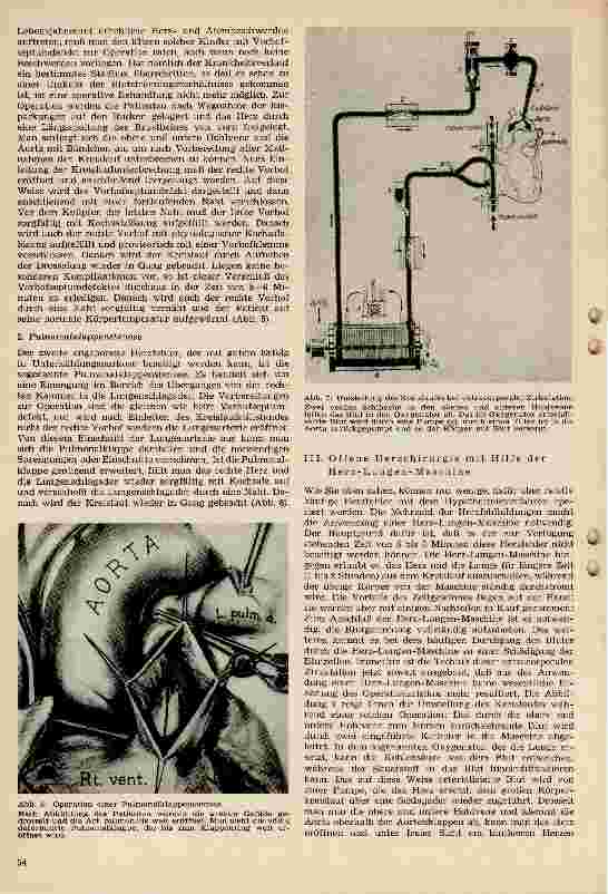 Vorschauseite 4: Herzchirurgie