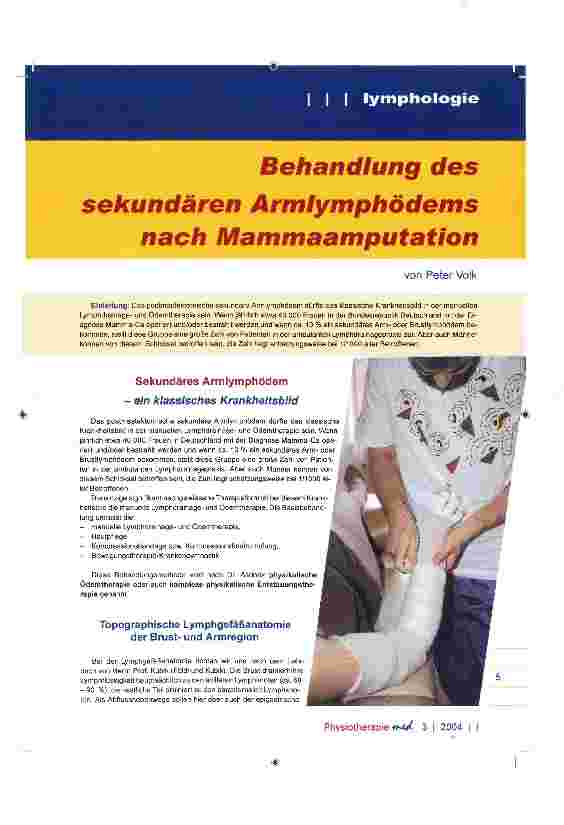 Vorschauseite 1: Behandlung des sekundären Armlymphödems nach Mammaamputation