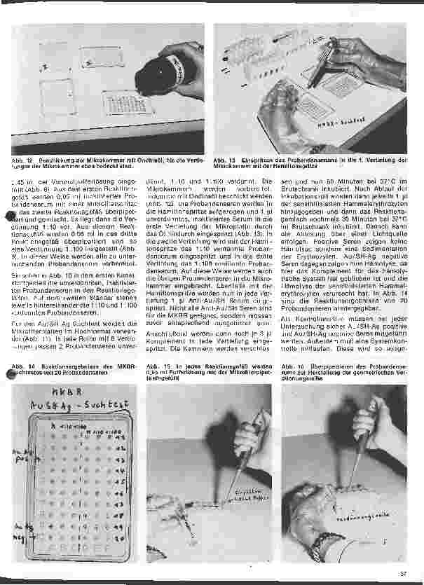 Vorschauseite 4: Transfusionskunde, Blutgruppenserologie und Immunhämatologie /29.Folge Empfindliche Untersuchungsmethoden zum Nachweiß v.Australia-Antigenen