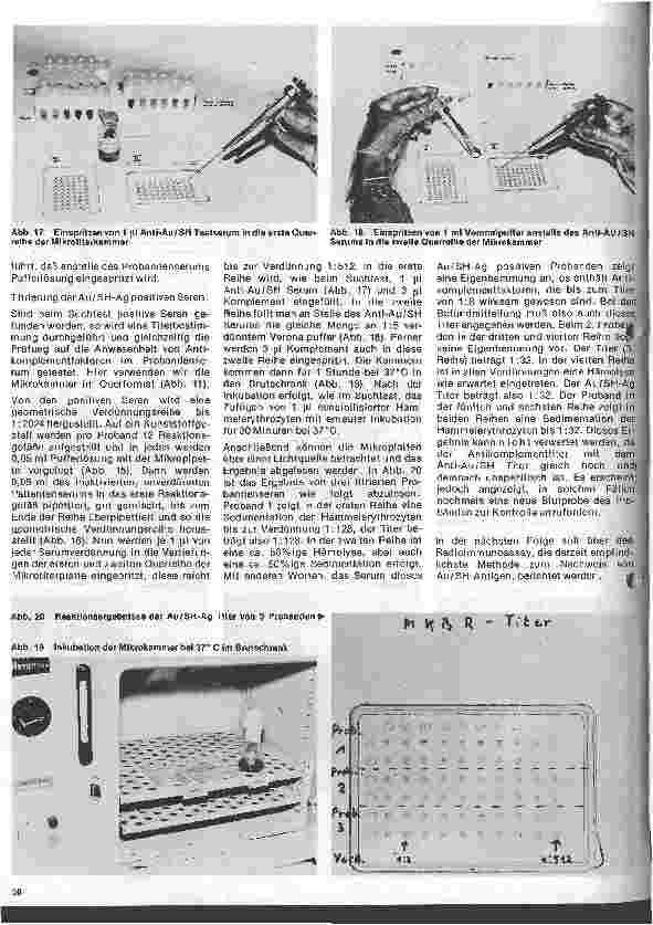 Vorschauseite 5: Transfusionskunde, Blutgruppenserologie und Immunhämatologie /29.Folge Empfindliche Untersuchungsmethoden zum Nachweiß v.Australia-Antigenen
