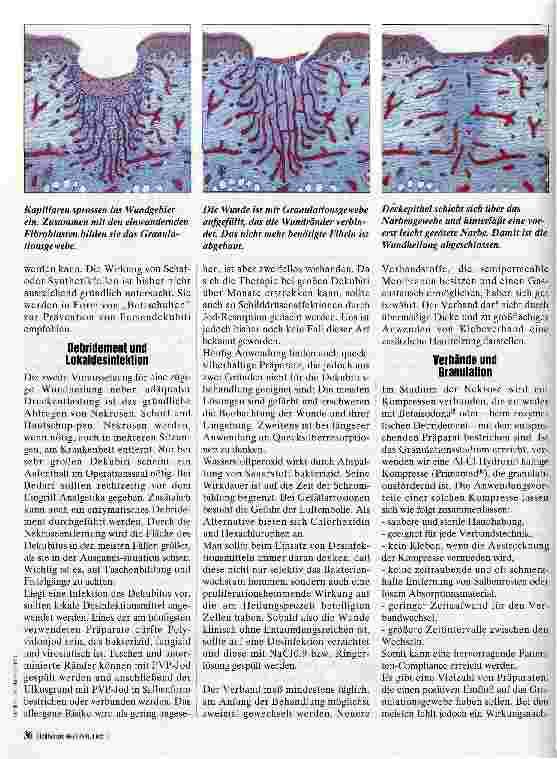 Vorschauseite 3: Dekubitus in der Geriatrie Pathophysiologische Vorstellung der Dekubitusentstehung