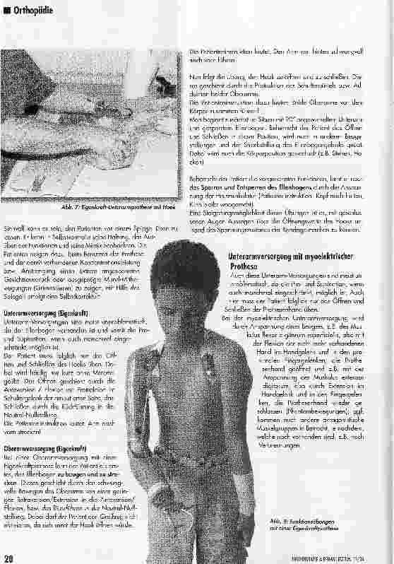 Vorschauseite 6: Training mit einer Armprothese nach Amputation
