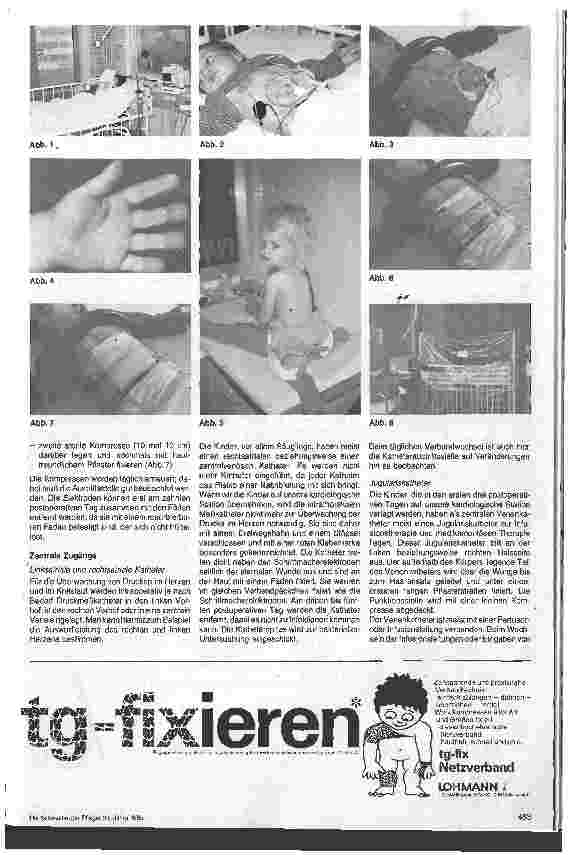 Vorschauseite 3: Die Pflege des herzkranken Säuglings und Kleinkindes vor und nach der Operation