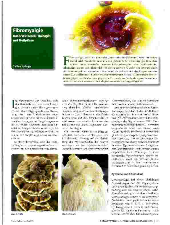 Vorschauseite 1: Fibromyalgie Unterstützende Therapie mit HeilpiEzen
