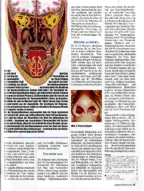 Vorschauseite 2: Immunologie der Nase Infektiöse und allergische Rhinitis