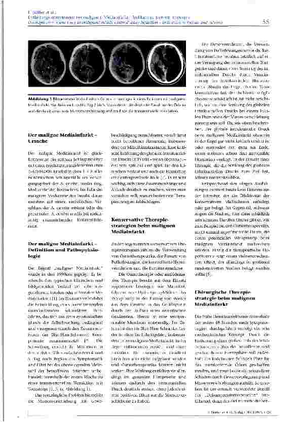 Vorschauseite 2: Entlastungskraniektomie bei malignem Mediainfarkt - Indikation, Technik, Outcome