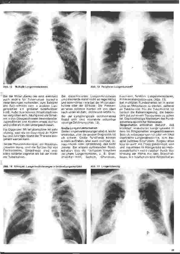 Vorschauseite 2: Radiologie 27. Folge: Röntgenuntersuchung der Thoraxorgane (Fortsetzung u.Schluß)