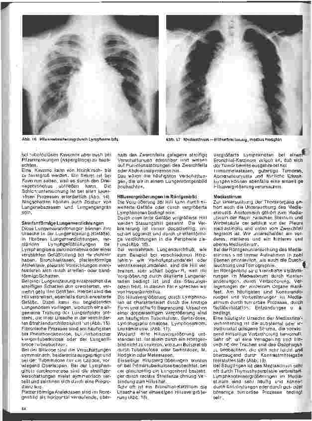 Vorschauseite 3: Radiologie 27. Folge: Röntgenuntersuchung der Thoraxorgane (Fortsetzung u.Schluß)