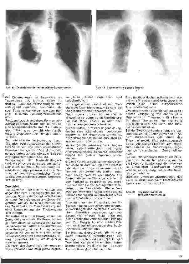 Vorschauseite 4: Radiologie 27. Folge: Röntgenuntersuchung der Thoraxorgane (Fortsetzung u.Schluß)
