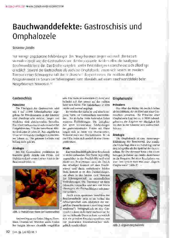 Vorschauseite 1: Bauchwanddefekte: Gastroschisis und Omphalozele