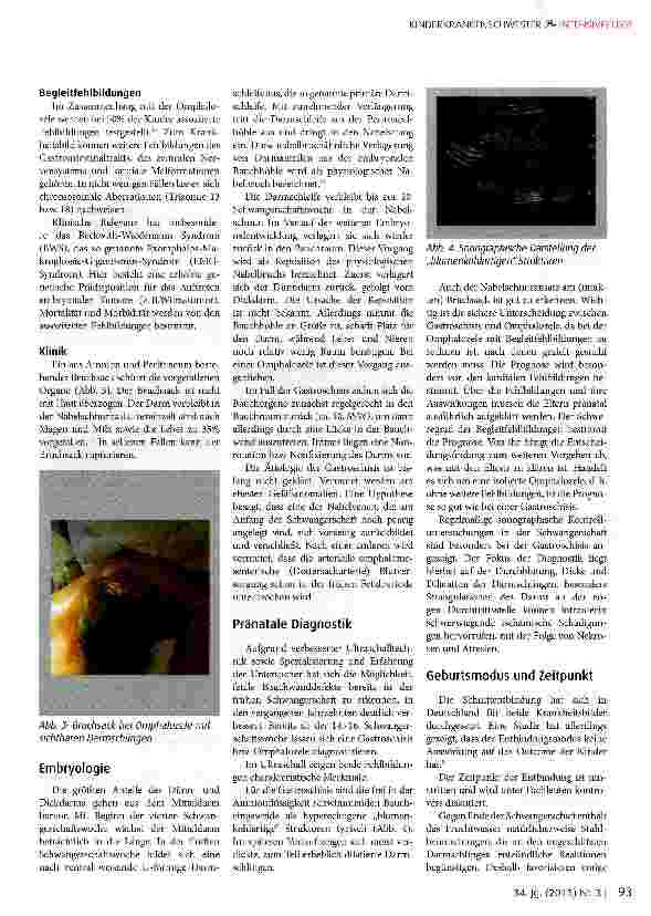 Vorschauseite 2: Bauchwanddefekte: Gastroschisis und Omphalozele