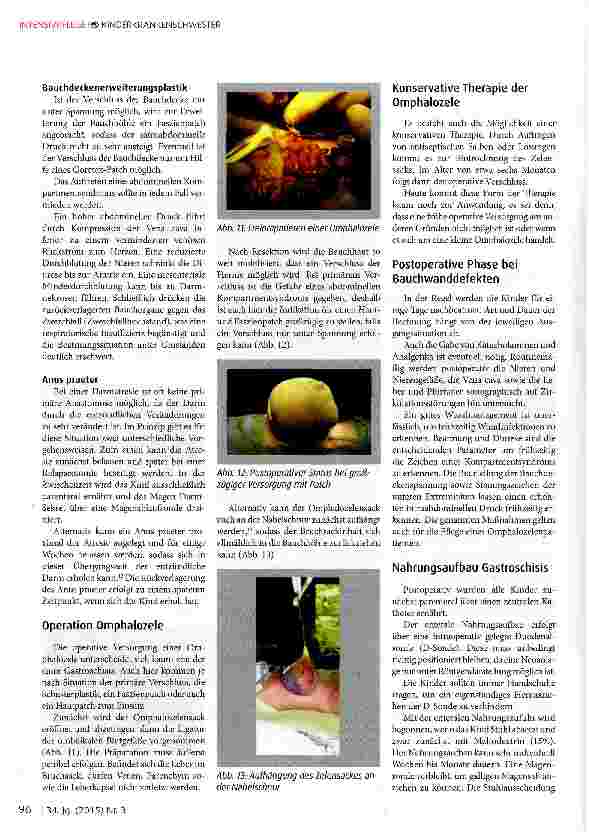 Vorschauseite 5: Bauchwanddefekte: Gastroschisis und Omphalozele