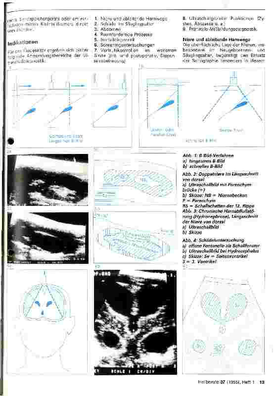 Vorschauseite 2: Indikation und Technik der Ultraschalltomographie im Kindesalter