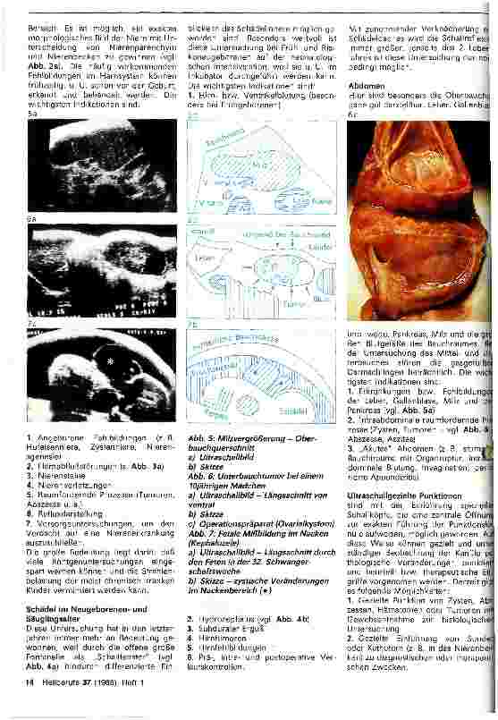 Vorschauseite 3: Indikation und Technik der Ultraschalltomographie im Kindesalter