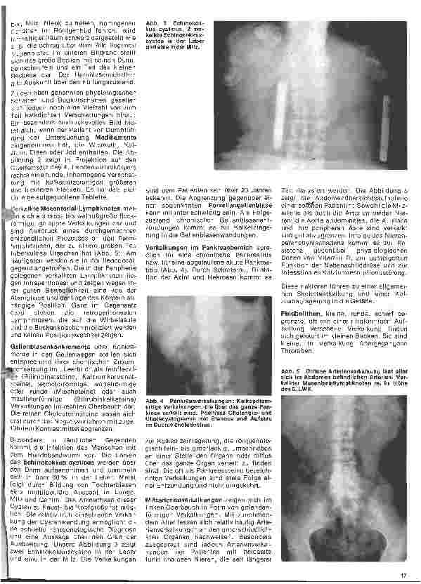 Vorschauseite 2: Radiologie 24. Folge: Röntgenuntersuchung des Abdomens