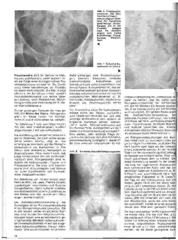 Vorschauseite 3: Radiologie 24. Folge: Röntgenuntersuchung des Abdomens