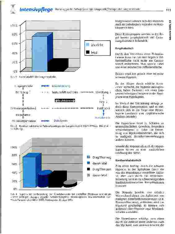 Vorschauseite 2: Pathophysiologie: Diagnostik/Therapie der Lungenembolie