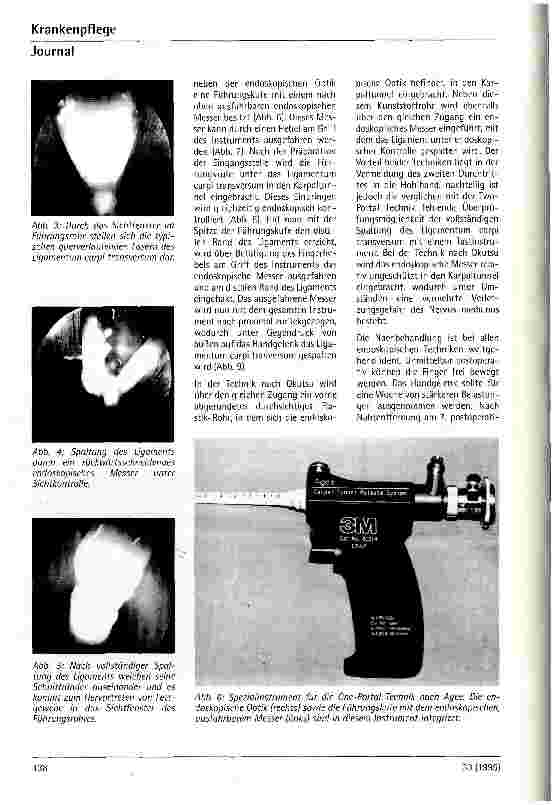 Vorschauseite 3: Endoskopische Karpaltunnelspaltung