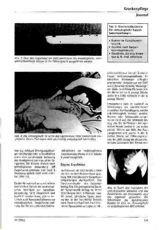 Vorschauseite 4: Endoskopische Karpaltunnelspaltung
