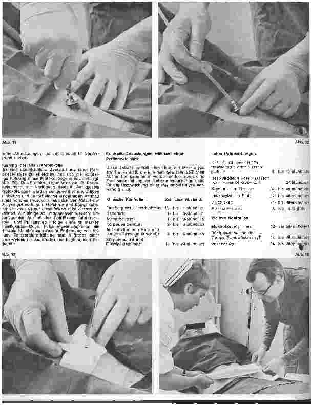 Vorschauseite 5: Peritonealdialyse