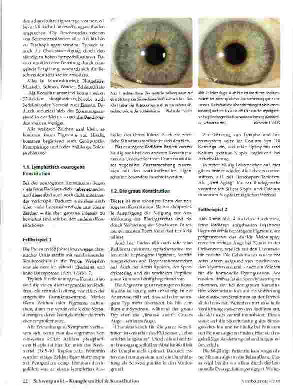 Vorschauseite 3: Lymphatische Konstitution Konstitutionen in der Augendiagnose - Teil 1