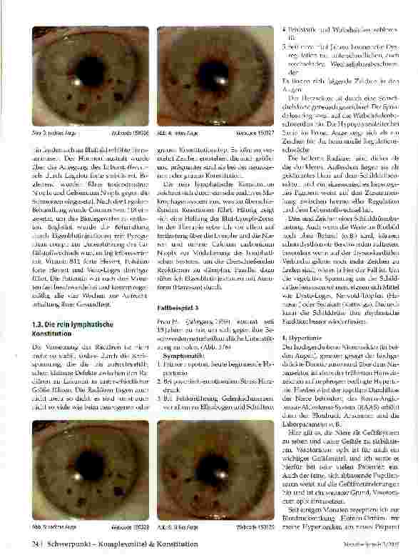 Vorschauseite 4: Lymphatische Konstitution Konstitutionen in der Augendiagnose - Teil 1