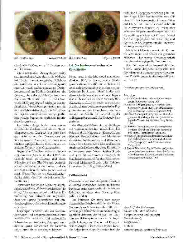 Vorschauseite 6: Lymphatische Konstitution Konstitutionen in der Augendiagnose - Teil 1