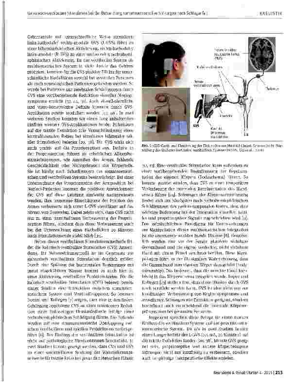 Vorschauseite 3: Galvanisch-vestibuläre Stimulation als Add-on-Verfahren bei der Behandlung somatosensorischer Störungen und Missempfindungen nach Schlaganfall: Drei Fallstudien