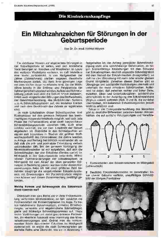 Vorschauseite 1: Ein Milchzahnzeichen für Störungen in der Geburtsperiode