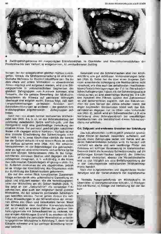 Vorschauseite 2: Ein Milchzahnzeichen für Störungen in der Geburtsperiode
