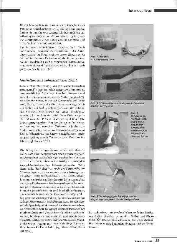 Vorschauseite 4: Zahnprothesen - Richtiger Umgang mit den Dritten
