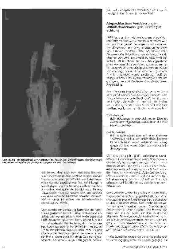 Vorschauseite 2: Unfallmäßige Selbstbeschädigung oder Obliegenheitsverletzung -Versicherungsbetrug als Hasard?