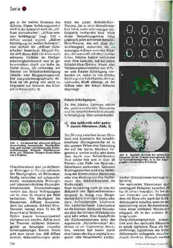 Vorschauseite 4: Postoperative Pflege in der Neurochirurgie 2.Folge: Schädel-Hirn-Trauma