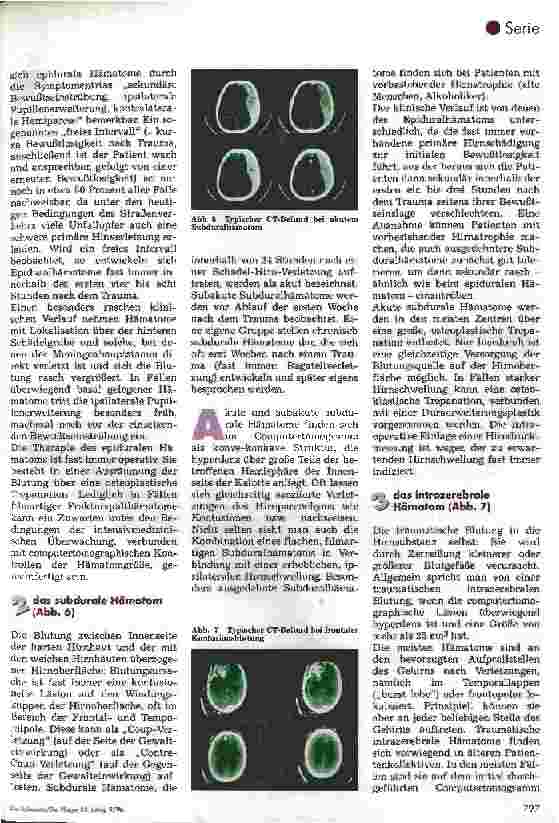 Vorschauseite 5: Postoperative Pflege in der Neurochirurgie 2.Folge: Schädel-Hirn-Trauma