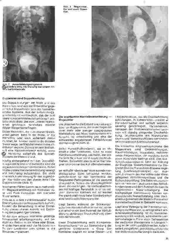 Vorschauseite 2: Urologie 11. Folge: Urologie im Kindesalter (II) Mißbildungen der Niere